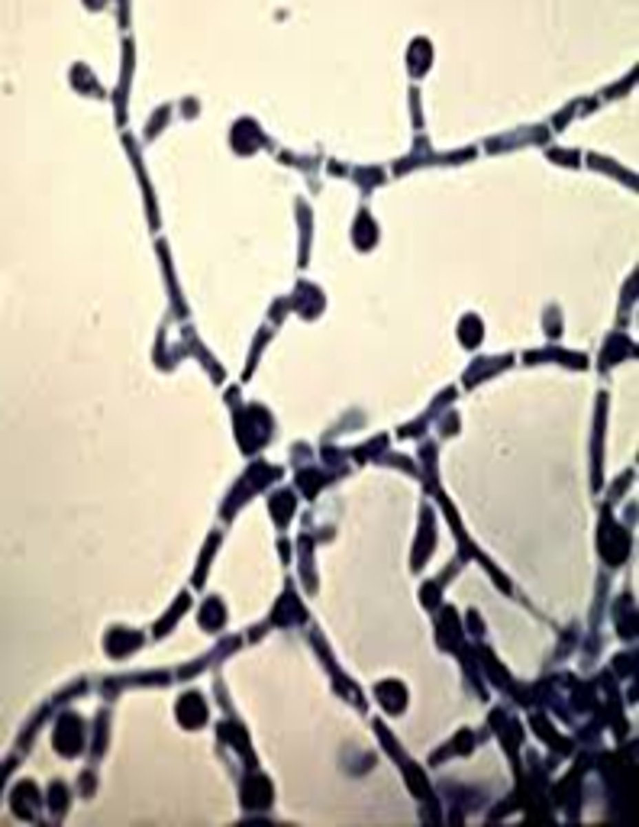 <p>Yeast: large, round "mariner's</p><p>wheel" with circumferential</p><p>budding</p><p>o Don't mix this up with H.</p><p>capsulatum's mold form</p><p>macroconidia</p><p>• Mold: septate, hyaline,</p><p>terminal and intercalary</p><p>chlamydospores</p>
