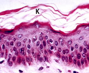 <p>celulele cele mai superficiale nu prezintă nuclei și formează scuamele de keratină care se elimină (se descuamează) de pe suprafață. Se găsește pe suprafața externă a corpului și este în general uscat</p>