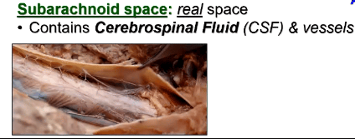 <p>cerebrospinal fluid (CSF)</p>
