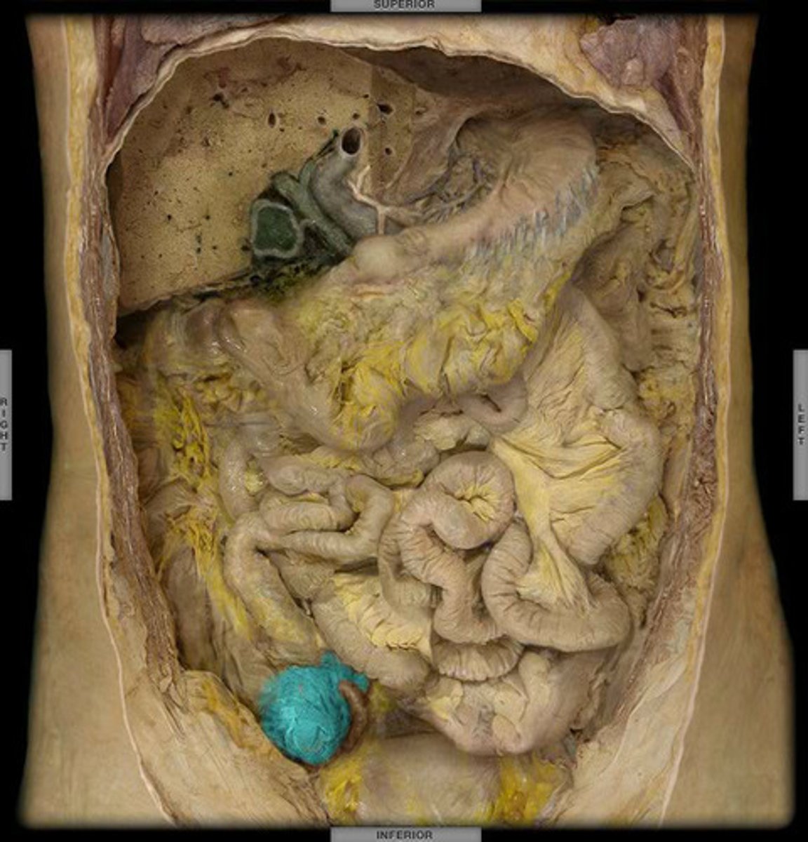 <p>the cavity in which the large intestine begins and into which the ileum opens</p>