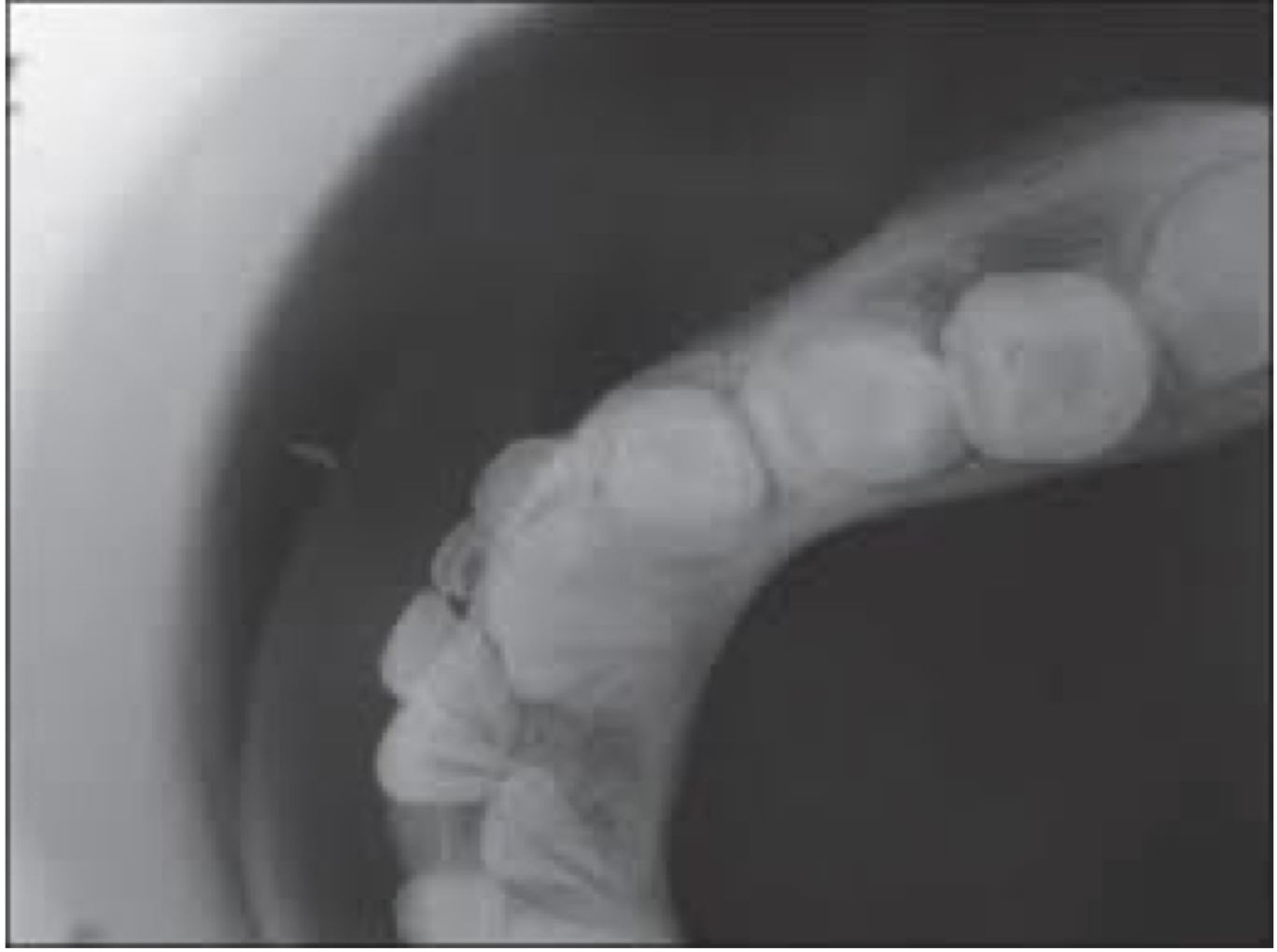 <p>Occlusal Radiograph</p>