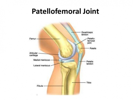 <p>What type of joint is the <strong>patella-femoral </strong>joint?</p>