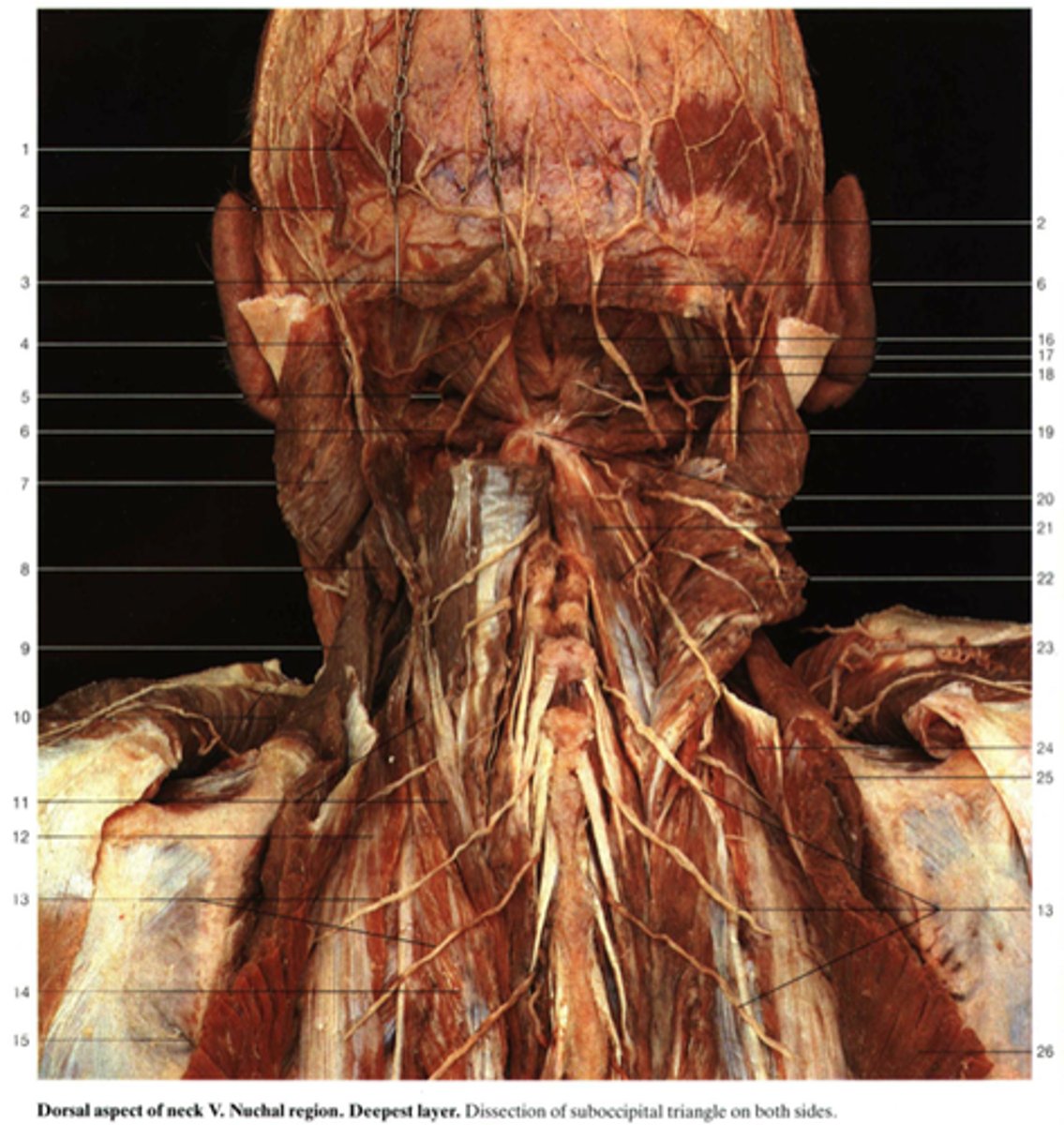 <p>Find and name the parts of the triangle. Which part isnt the triangle?</p>