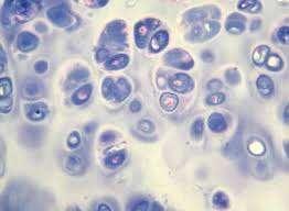 <p>Small cavity in cartilage or bone matrix housing a cell.</p>