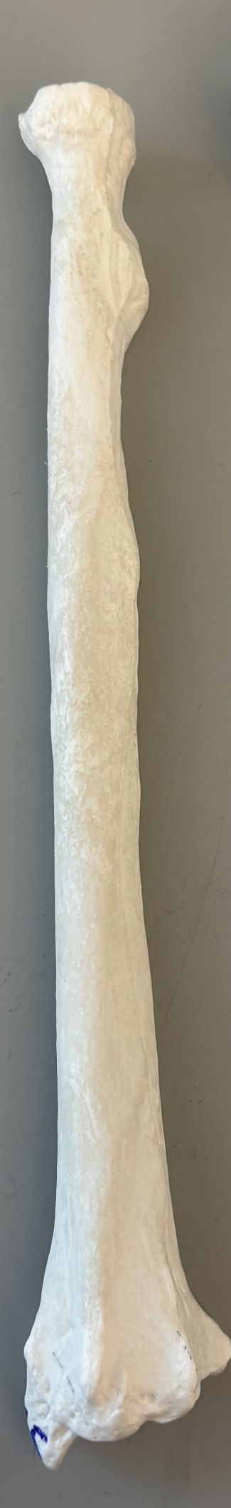 <p>what is this bone</p>
