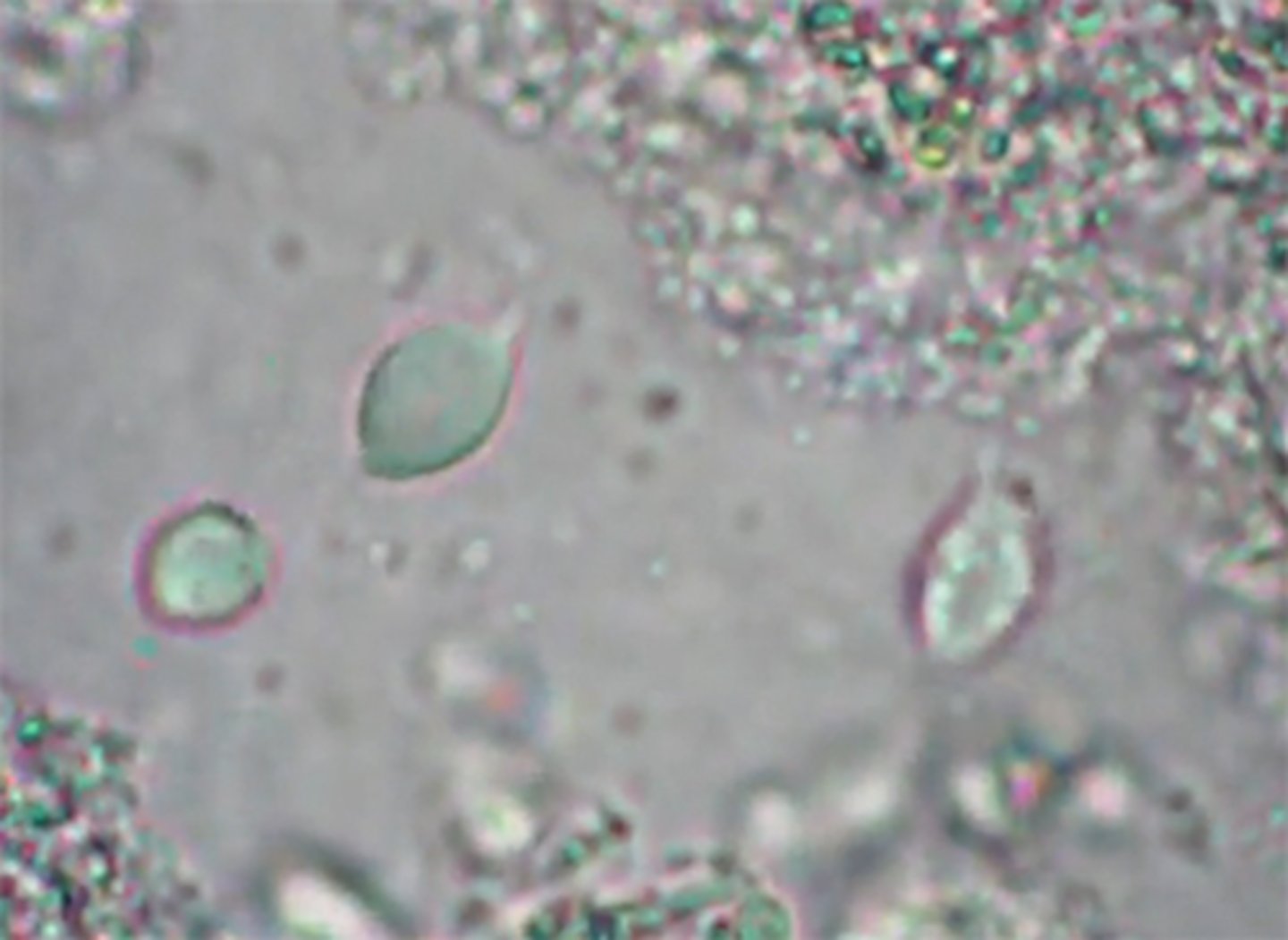 <p>flagella in saline</p>