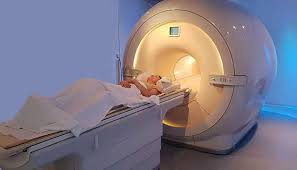 <p>CT (computed tomography) Scan</p>
