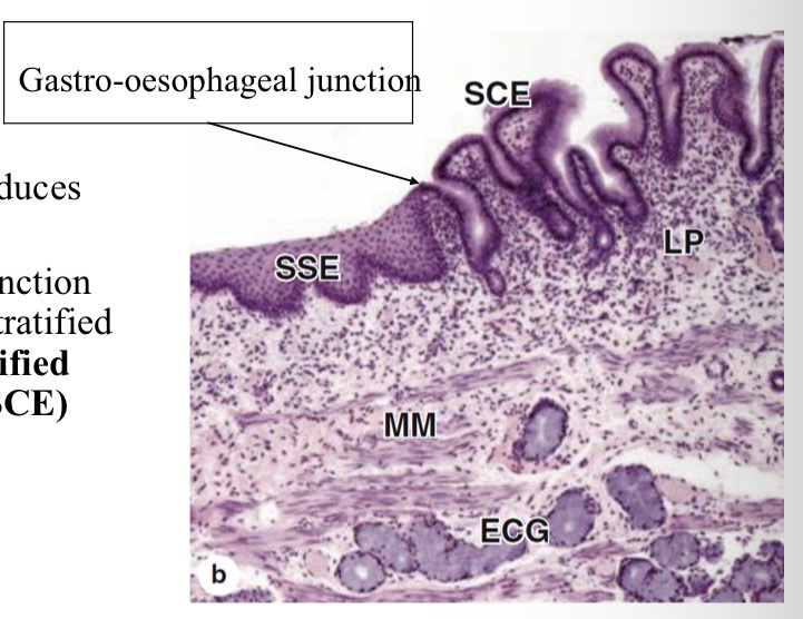 <ul><li><p>Stomach epithelium → produces acids and enzymes </p></li><li><p>At gastrointestinal-oesophageal junction there is a transition from stratified squamous (SSE) to stratified columnar epithelium (SCE)</p></li></ul><p></p>
