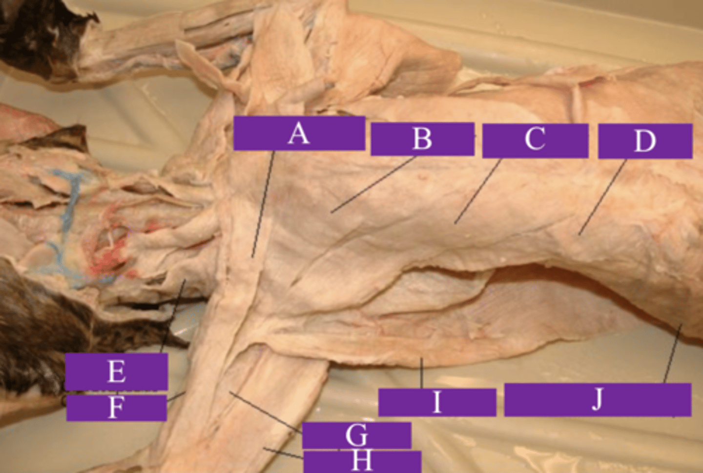 <p>What is letter I?</p>