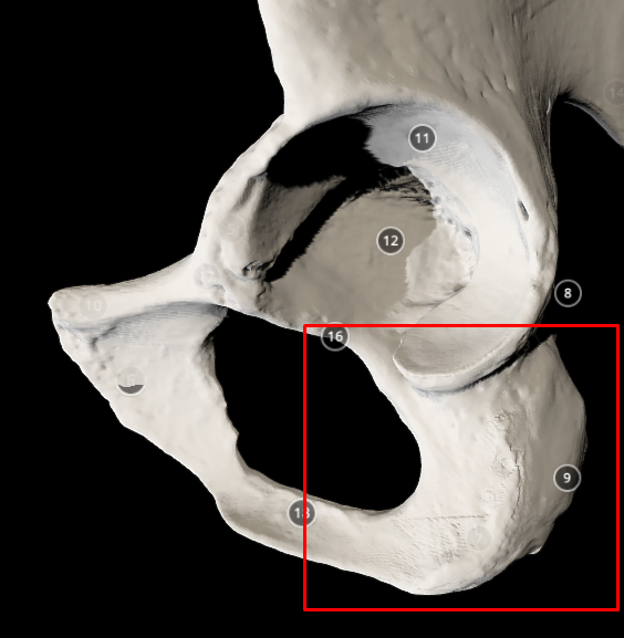 <p>ischial tuberosity - big bump near the acetabulum fossa</p>