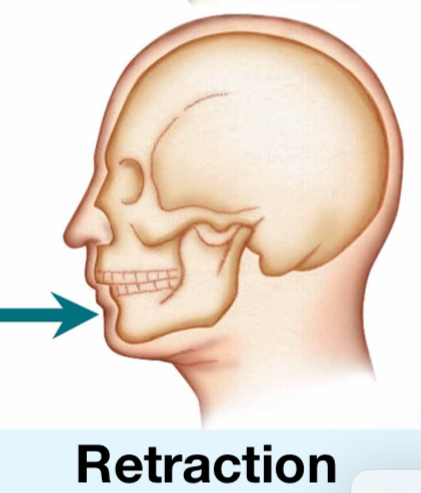 <p>Retraction</p>