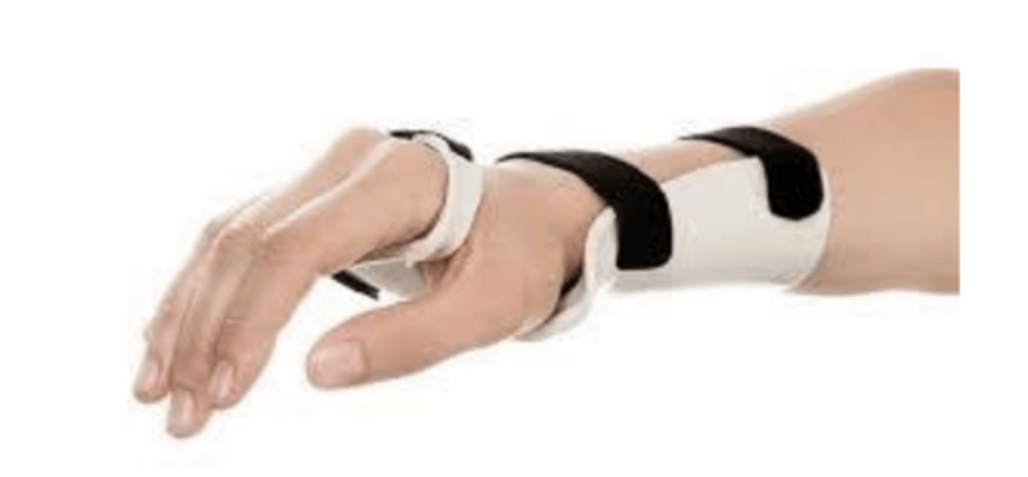 <p>cock-up wrist/finger splints, avoidance of further compression, PT/OT</p>