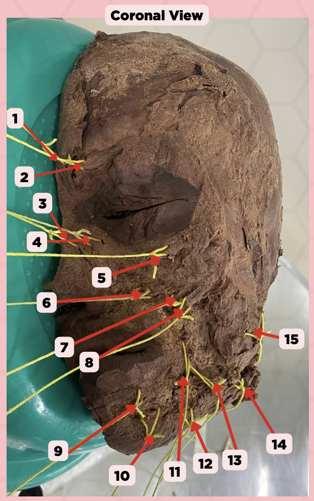 <p>Identify the structure labeled as 8.</p>