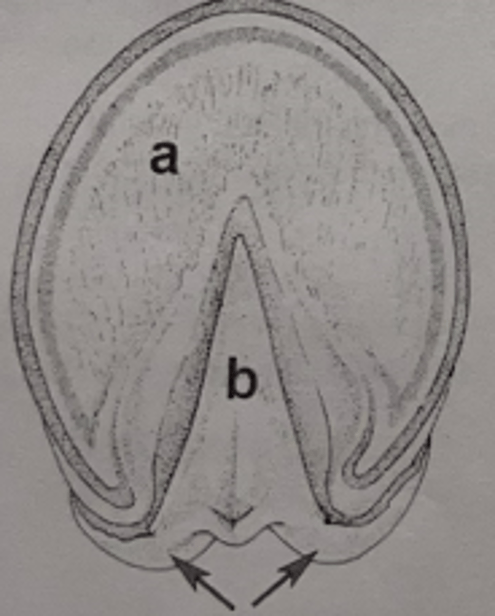 <p>What region of the hoof is A?</p>