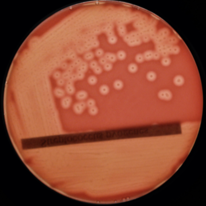 <p>Cream/ off white colonies</p><p>Raised opaque centres</p><p>Large zone of complete haemolysis</p><p>Lancefield group A</p><p>Ctalase negative</p><p>Gram +</p>