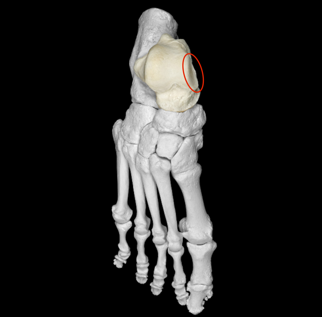 <p>medial side of trochlea </p>