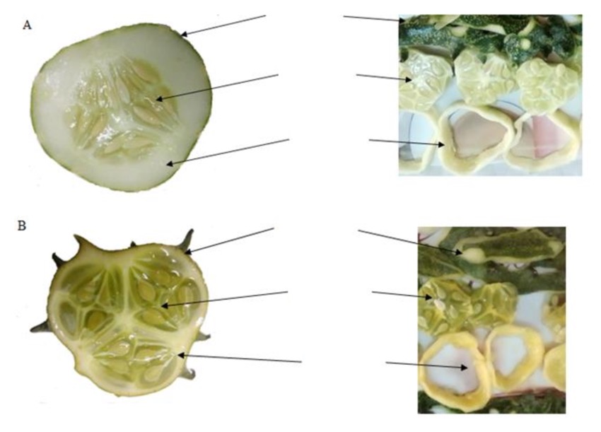 <p>Identify the pericarp layers.</p>