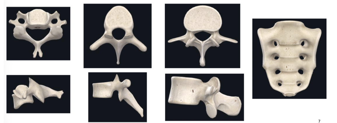 <p><span><strong>Distinct regional features of vertebrae</strong></span></p>
