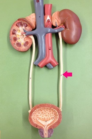 <p>tube that carries urine from the kidney to the urinary bladder</p>