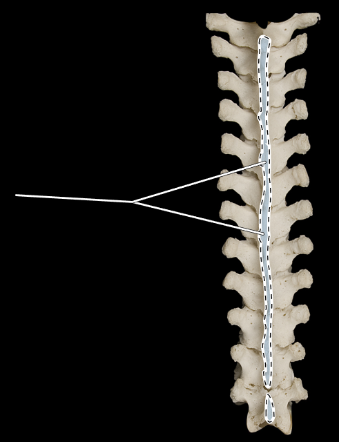 <p>What part of the vertebra is highlighted?</p><p>What region of the vertebral column is this?</p><p>(Posterior view).</p>