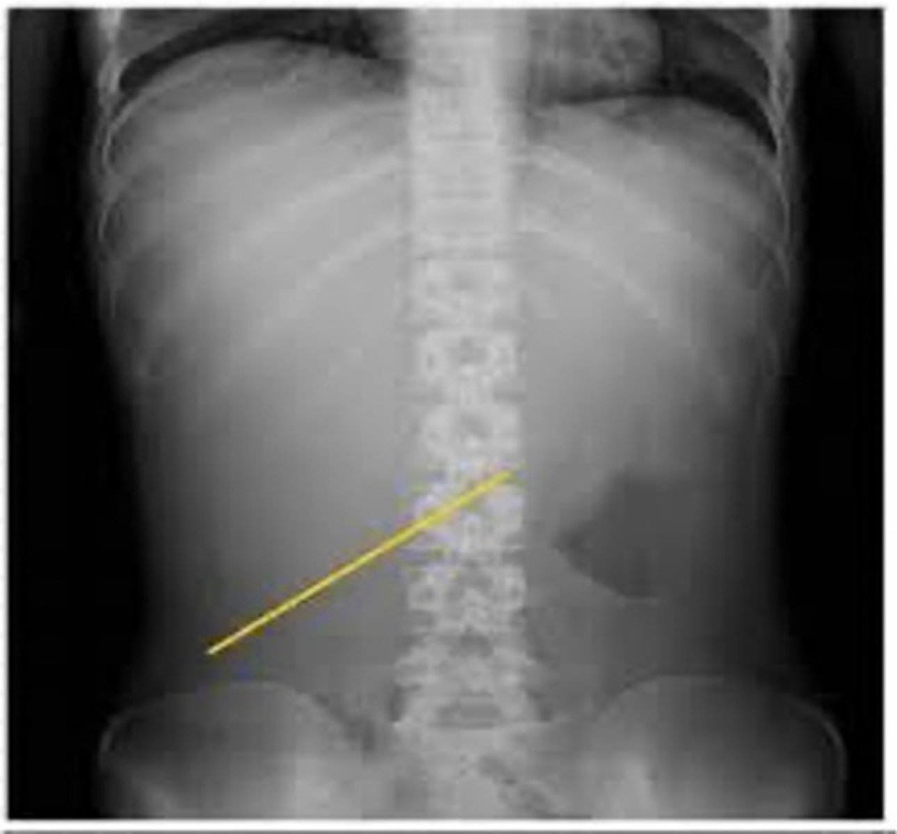 knowt flashcard image