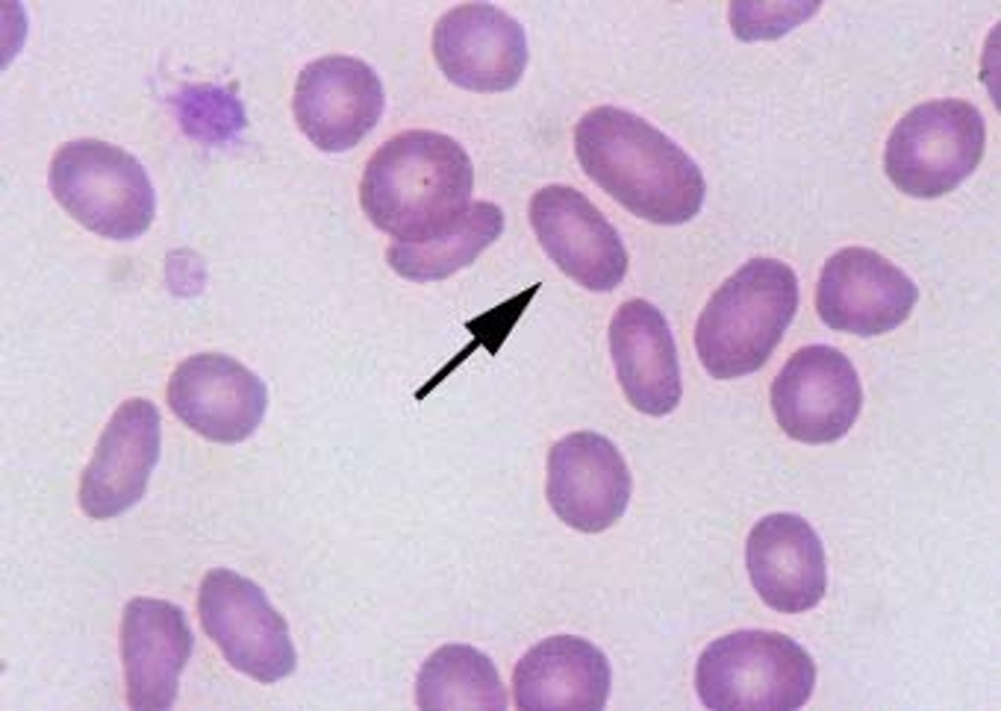 <p>oval shaped, hereditary in dogs, myelofibrosis, MDS, cats with bone marrow disease, hepatic lipidosis</p>