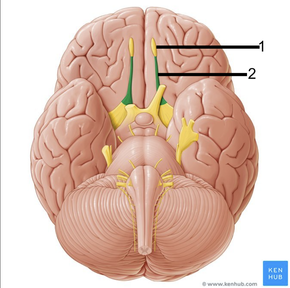 <p>What structure of the brain is this? #2</p>