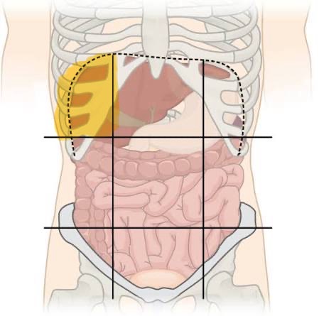 <p>Right Hypochondriac</p>