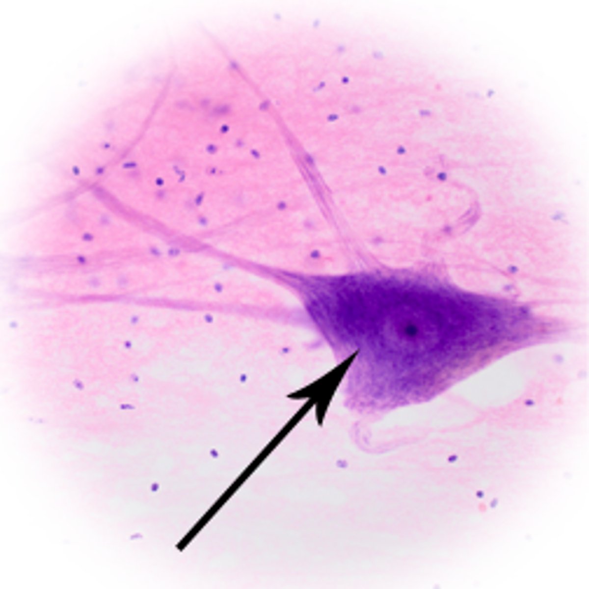 <p>Largest part of a typical neuron; contains the nucleus and much of the cytoplasm</p>