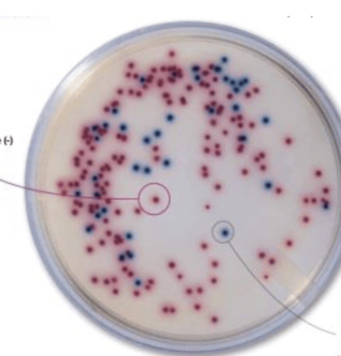 <p>the purple colonies on this ASAP agar plate are what bacteria?</p>