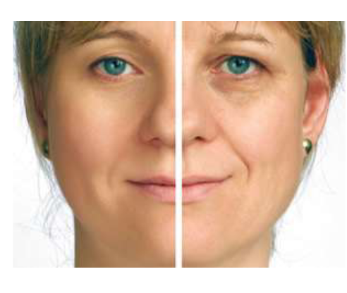 <p>What happens when Botox is applied on your face?</p>