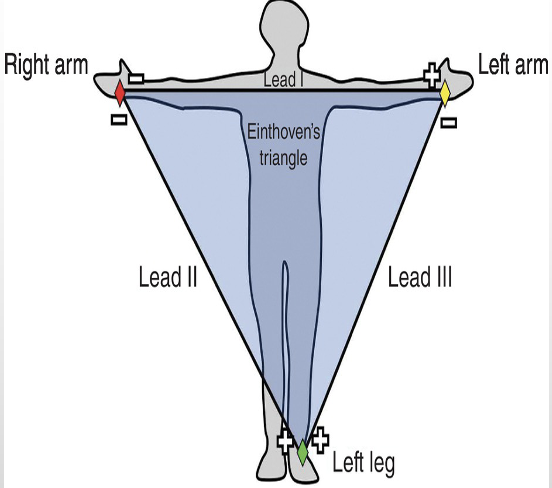 <p>What is Einthoven’s triangle?</p>