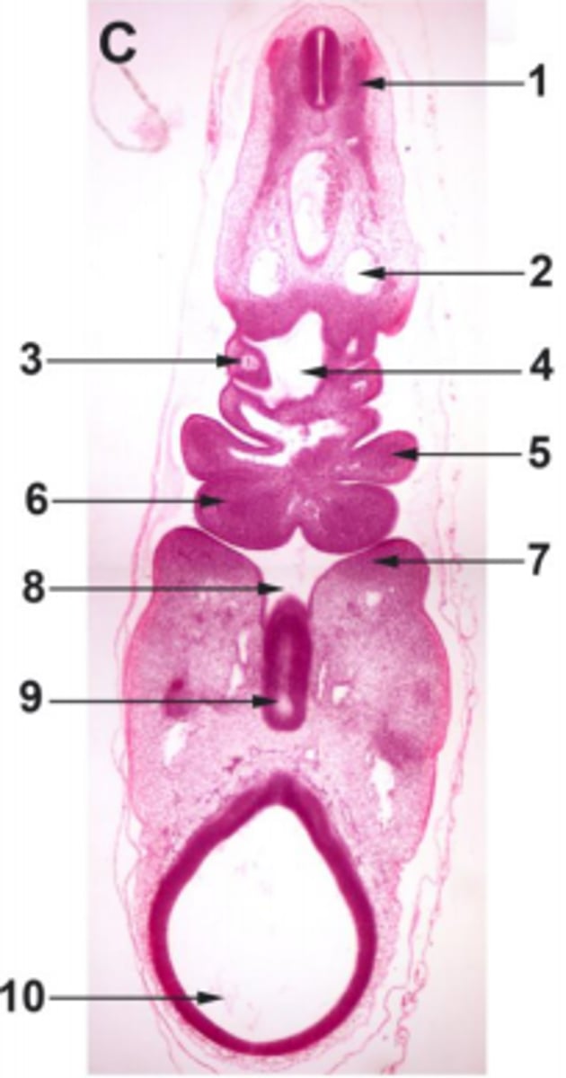 <p>#5 endoderm</p>