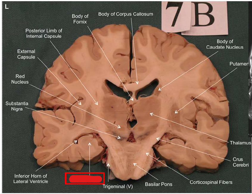 term image