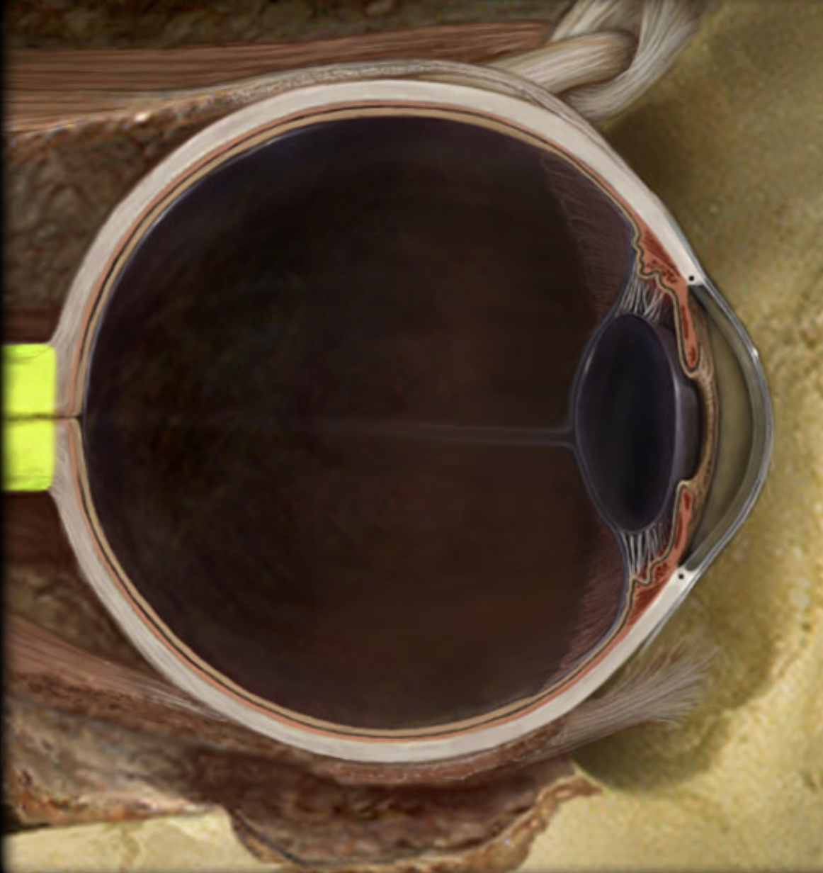 term image