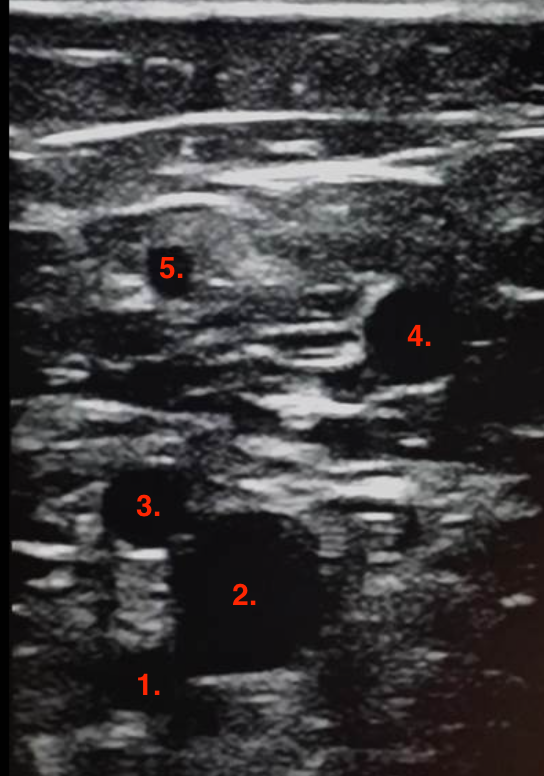<p>Identify this image. </p>