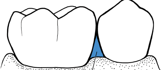 <p></p>