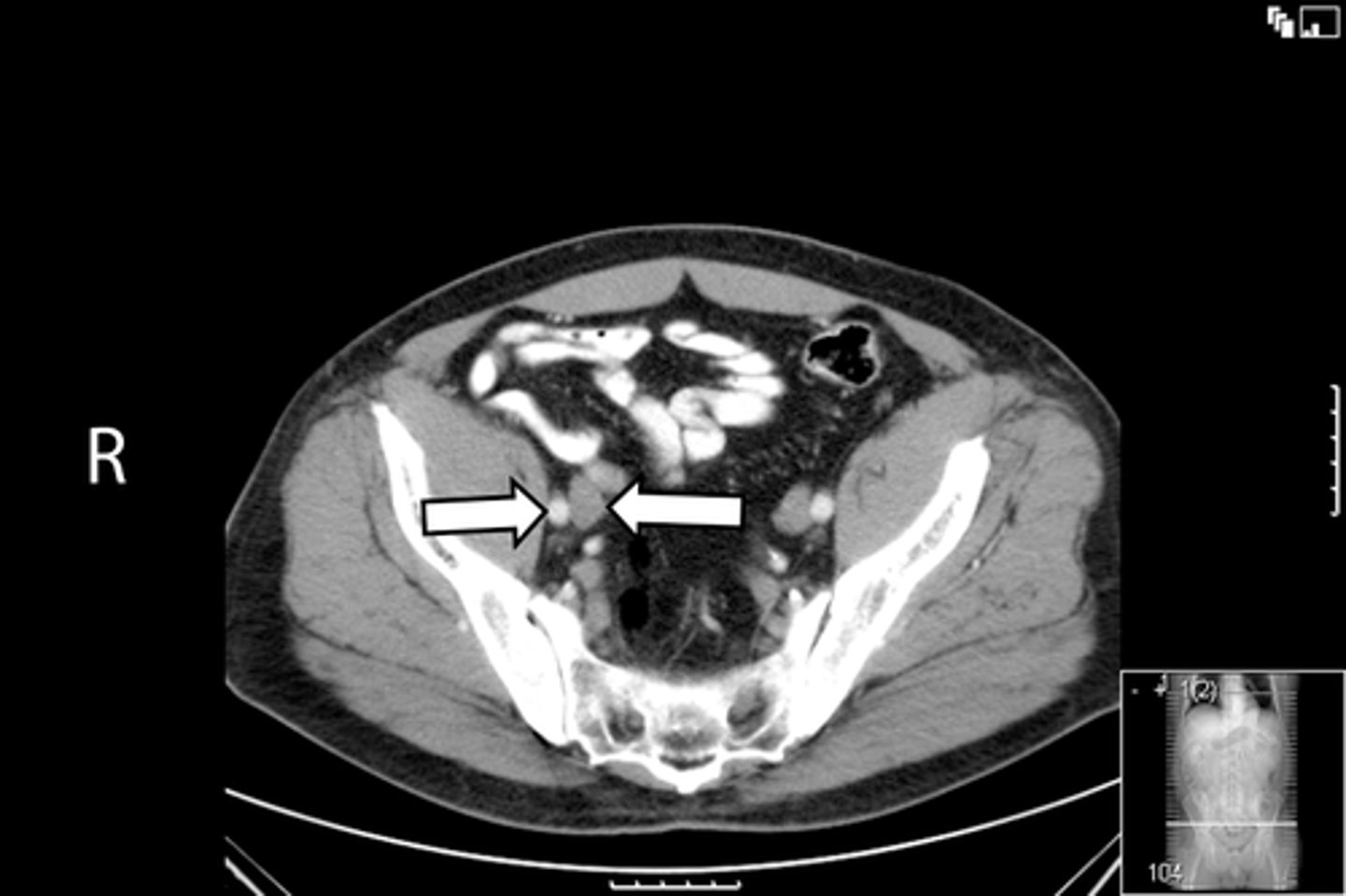 <p>What is indicated in the image?</p>