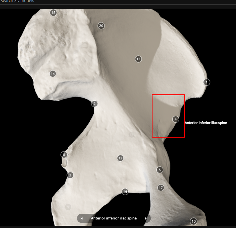 <p>anterior inferior iliac spine</p>