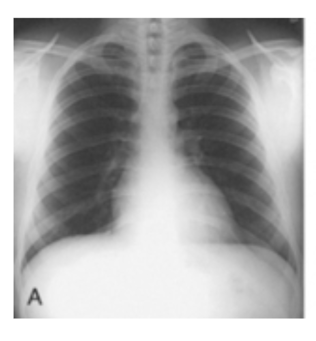 <p>Identify which body habitus this is</p>