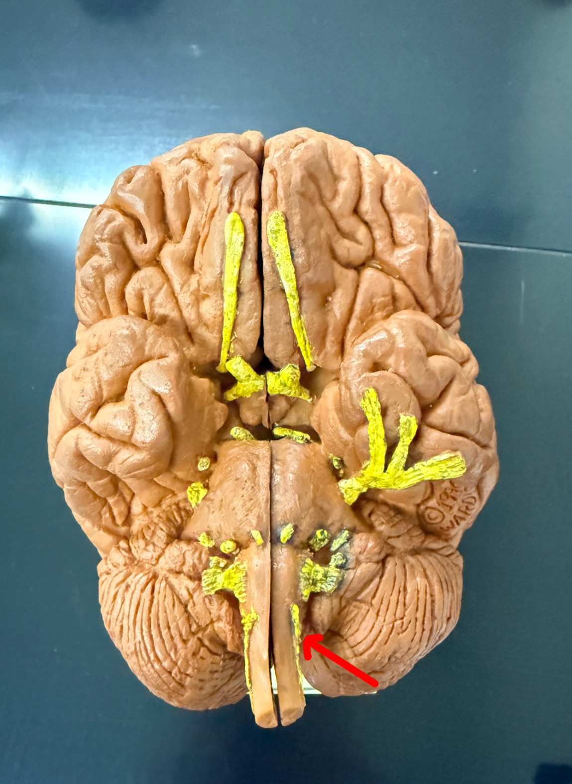 <p>Name the cranial nerve on the brain model</p>
