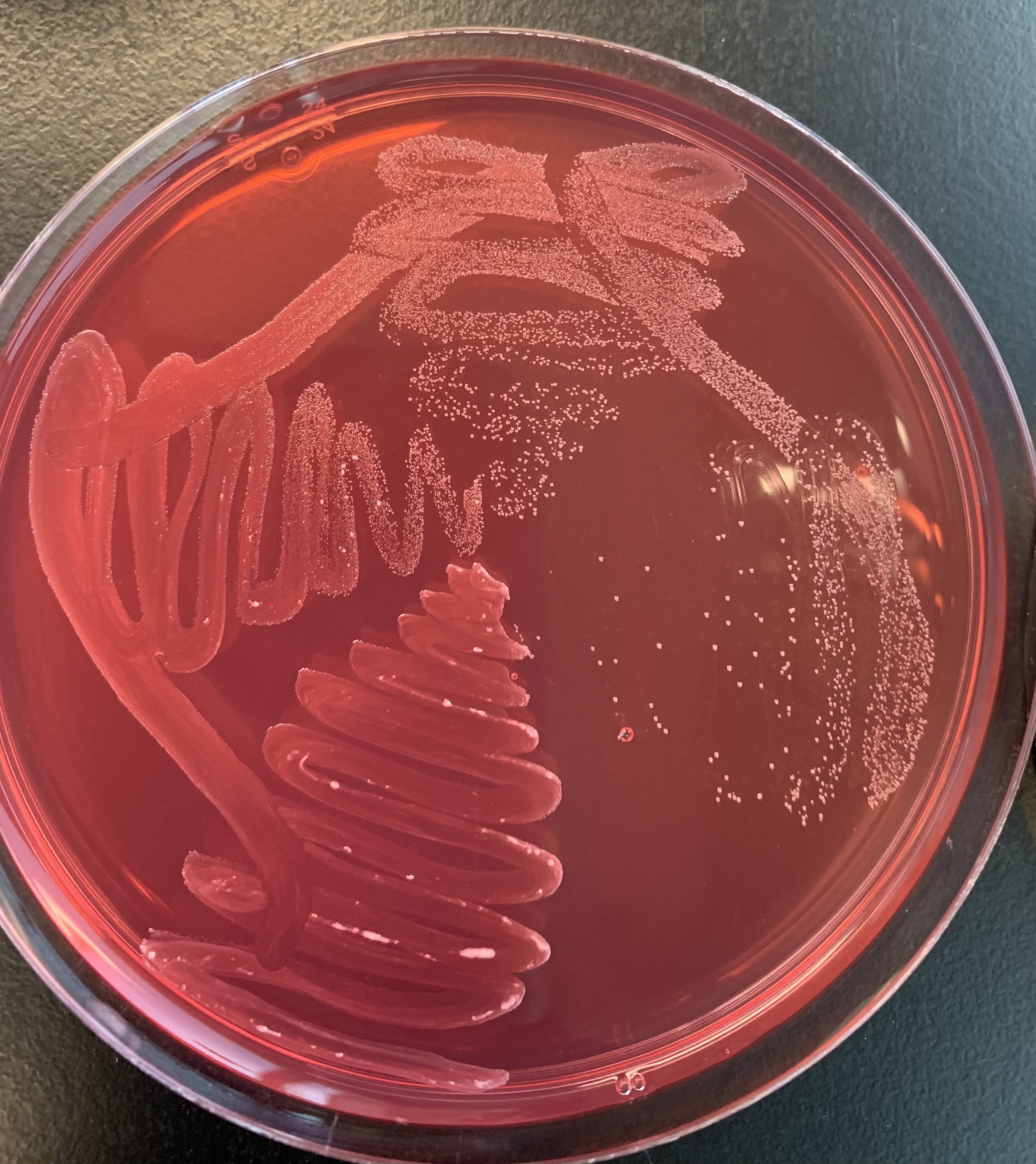 <p>What does a negative test of the MSA Salt agar plate indicate?</p>