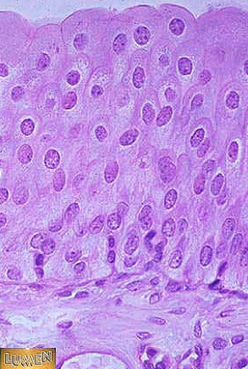 <p>Description: resembles both stratified squamous and stratified cuboidal; basal cells cuboidal or columnar, surface cells dome shaped or squamouslike, depending on degree of organ stretch</p><p>Function: Stretches readily, permits stored urine to distend urinary organ</p><p>Location: lines the ureters, bladder, and part of the urethra</p>