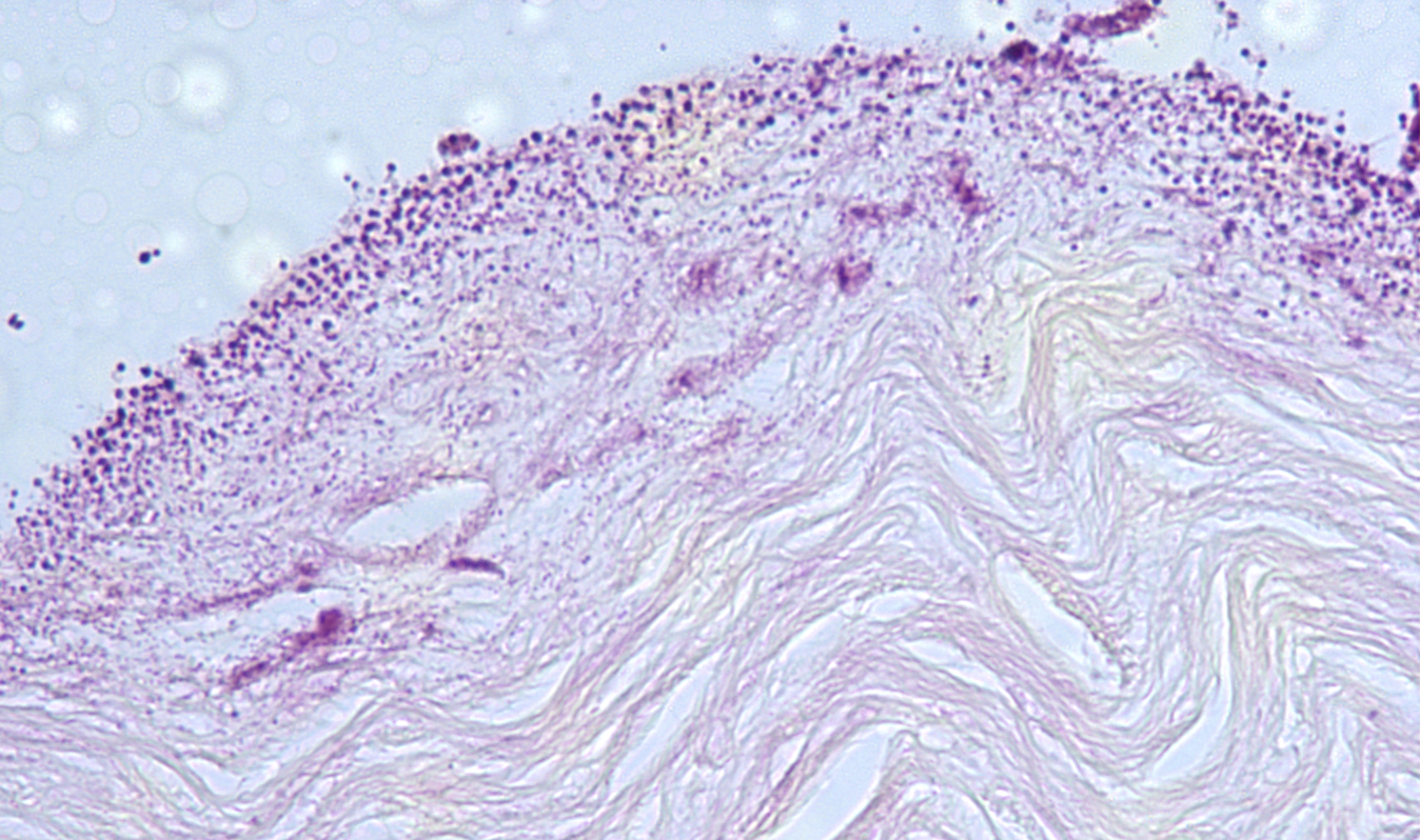 <p>ID the stain type </p>