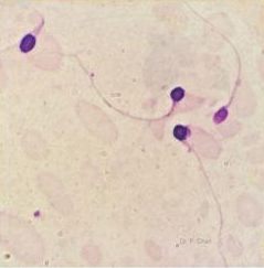 <p>Identify the sperm morphology.</p>