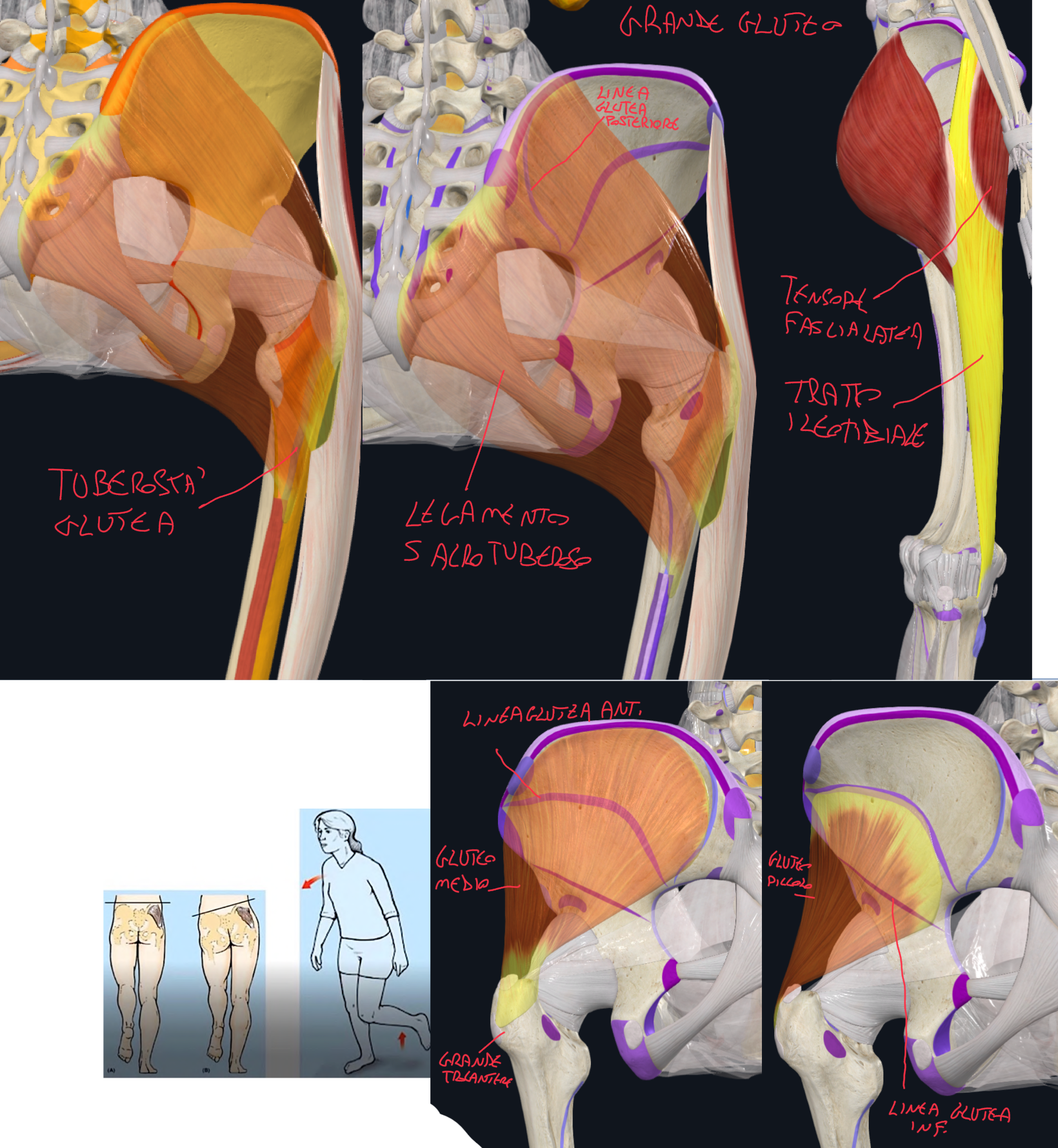<p>Sono 3 e vanno dall’Ileo al Femore:</p><ul><li><p>Grande, medio e piccolo gluteo.</p></li><li><p>Il grande gluteo è il più voluminoso e superficiale</p></li></ul><p>GRANDE GLUTEO:</p><ul><li><p>Origine:</p><ul><li><p>Posteriormente alla Linea Glutea Posteriore presente sulla superficie laterale dell’ala dell’ileo,</p></li><li><p>Margine laterale della superficie posteriore del sacro</p></li><li><p>Legamento sacrotuberoso</p></li></ul></li><li><p>Inserzione:</p><ul><li><p>Tratto Ileotibiale</p></li><li><p>Tuberosità Glutea del femore.</p></li></ul></li><li><p>Innervazione → Nervo Gluteo Inferiore</p></li><li><p>Funzione</p><ul><li><p>Coinvolto nell’estensione ginocchio grazie al contatto con il tratto ileotibiale nel mantenimento della posizione eretta prolungata.</p></li><li><p>Coinvolto nell’estensione dell’anca non attivamente, ma quando ci dobbiamo alzare o raddrizzare da una posizione flessa</p></li><li><p>Rotazione laterale anca.</p></li></ul></li></ul><p>MEDIO GLUTEO:</p><ul><li><p>Origine → superficie laterale ileo, tra cresta iliaca e linee glutee anteriore e posteriore</p></li><li><p>Inserzione → grande trocantere del femore (superficie laterale)</p></li></ul><p>PICCOLO GLUTEO:</p><ul><li><p>Origine → superficie laterale ileo, tra linea glutea anteriore e inferiore</p></li><li><p>Inserzione → grande trocantere del femore (superficie anteriore)</p></li></ul><p>Funzione medio e piccolo gluteo:</p><ul><li><p>Principali Abduttori dell’anca (insieme al tensore della fascia lata)</p></li><li><p>Stabilizzano la pelvi durante la deambulazione, infatti in caso di deficit, la pelvi pende verso il lato non in appoggio (si ha andatura anserina)</p><ul><li><p>Segno di Trendelenburg positivo → quando sollevando un arto, la pelvi cade verso il lato sollevato.</p></li></ul></li><li><p>Quindi se si lesionano i muscoli sx, la pelvi pende a dx</p></li></ul><p>Innervazione:</p><ul><li><p>Medio e piccolo innervati dal Nervo Glueo Superiore</p></li></ul><p></p>