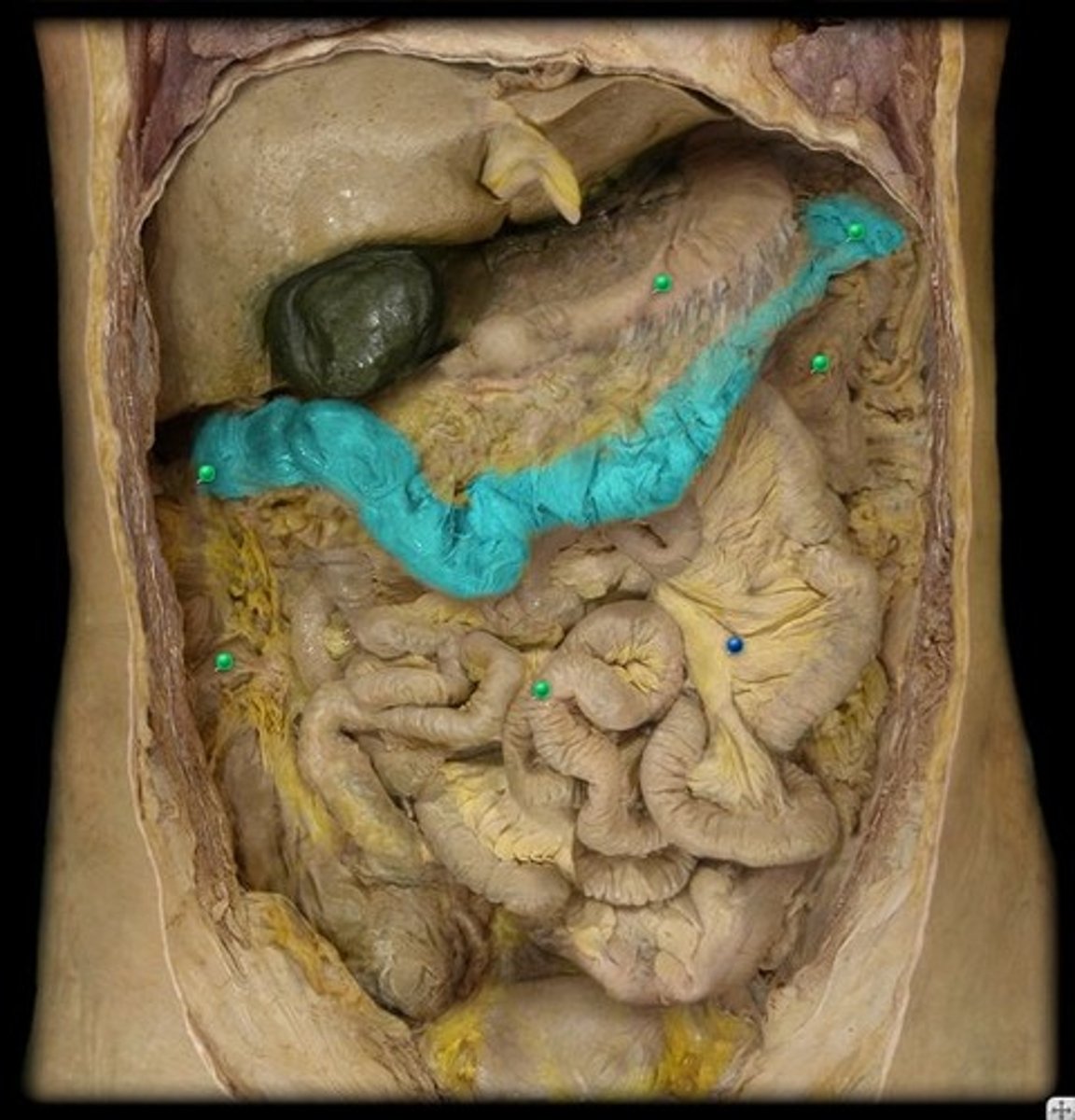 <p>What part of the large intestine is this?</p>