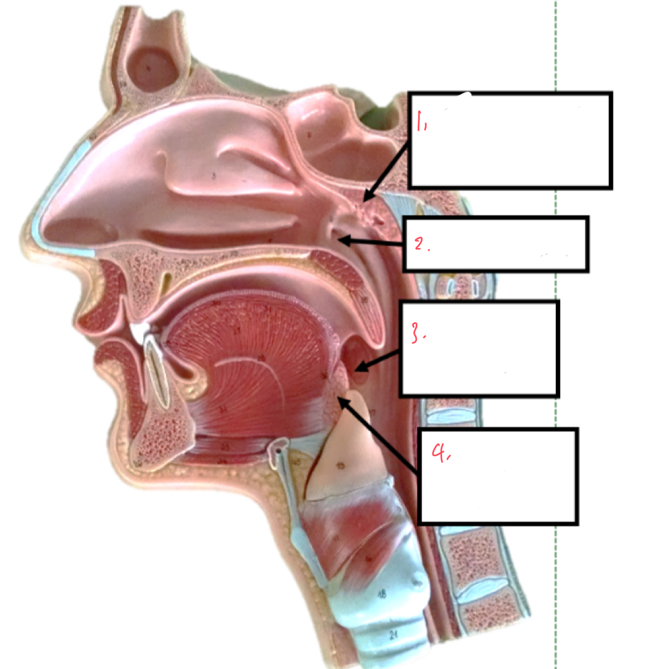 <p>identify the following tonsils</p>