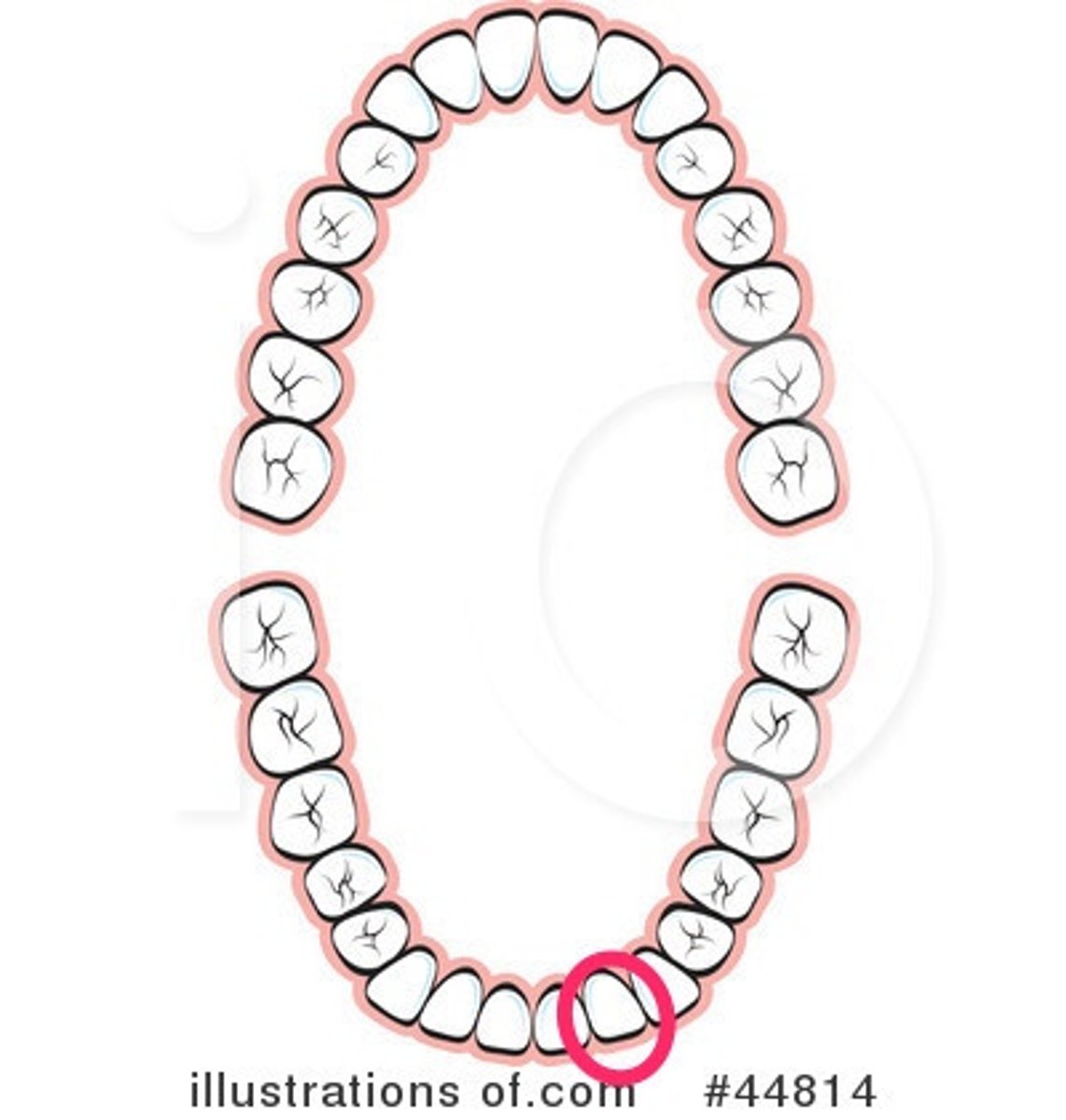 <p>LL lateral incisor</p>