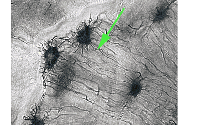 <p>What are the tiny tunnels represented by the green arrow, which allow osteocytes to communicate?</p>